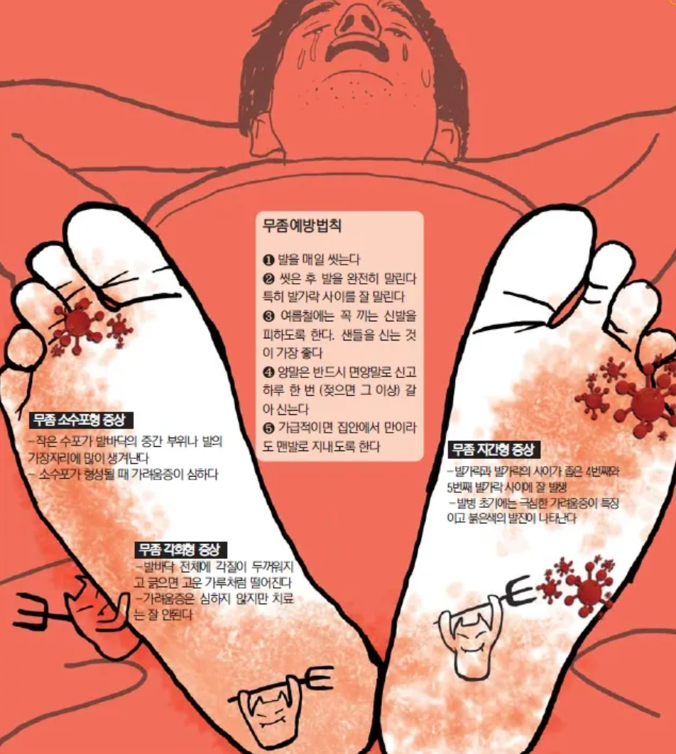 무좀 병원 어디로